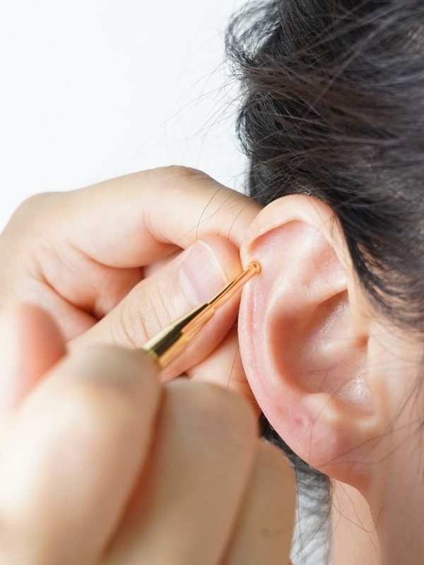 kwellness, traditionalmedicine, koreanmedicineclinic, nikom, acupuncture, kheritagehealth, pulsediagnosis, wellnessclinic, moxibustion, cuppingtherapy